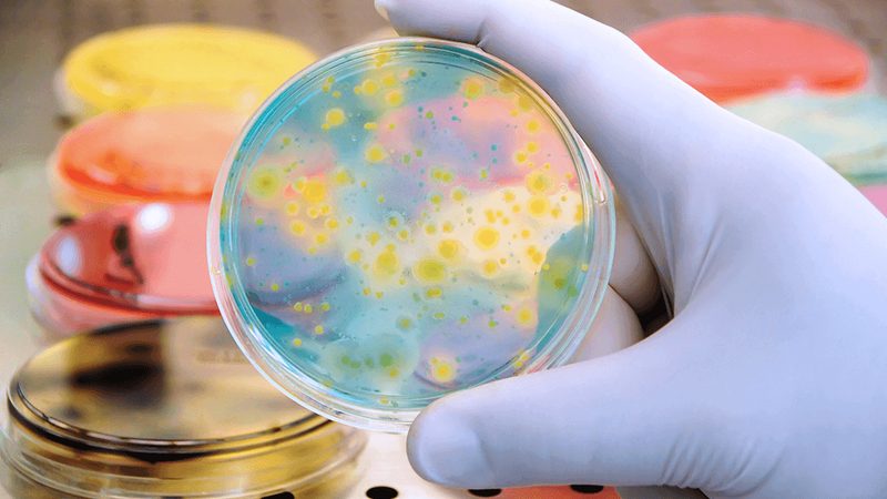实时荧光PCR检测：流程解析与关键要点